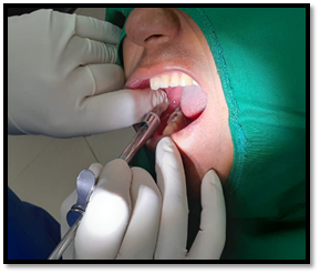 Una mujer con cepillo de dientes en la boca

Descripción generada automáticamente con confianza baja