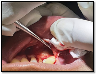 Un perro caliente en la mano

Descripción generada automáticamente con confianza media