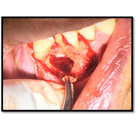 Imagen que contiene comida, plato, pieza, cerca

Descripción generada automáticamente