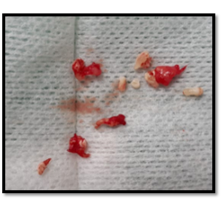 Una flor roja

Descripción generada automáticamente con confianza baja