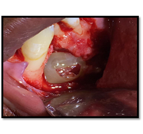 Perro caliente con salsa de tomate

Descripción generada automáticamente