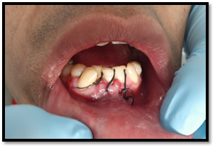 Imagen que contiene persona, boca, comida, caliente

Descripción generada automáticamente