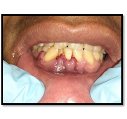 Un hotdog en la mano

Descripción generada automáticamente con confianza media