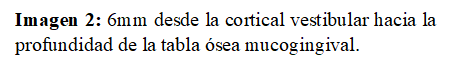 Imagen 2: 6mm desde la cortical vestibular hacia la profundidad de la tabla ósea mucogingival.  