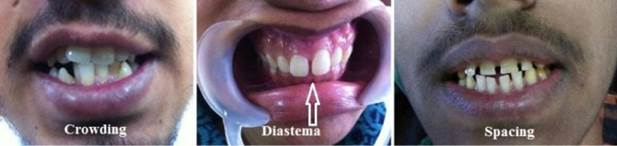 Un archivo externo que contiene una imagen, ilustración, etc. El nombre del objeto es TODENTJ-9-250_F1.jpg