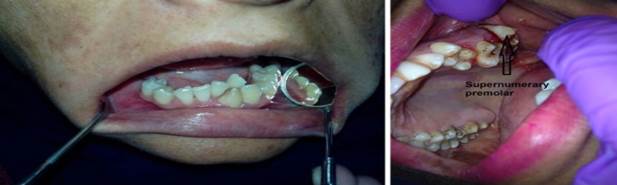 Un archivo externo que contiene una imagen, ilustración, etc. El nombre del objeto es TODENTJ-9-250_F2.jpg