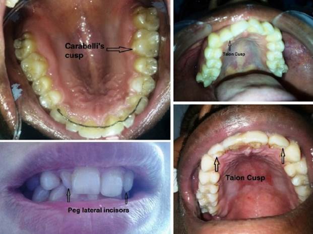 Un archivo externo que contiene una imagen, ilustración, etc. El nombre del objeto es TODENTJ-9-250_F3.jpg