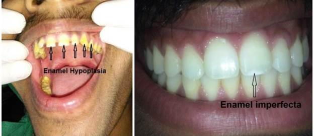 Un archivo externo que contiene una imagen, ilustración, etc. El nombre del objeto es TODENTJ-9-250_F4.jpg