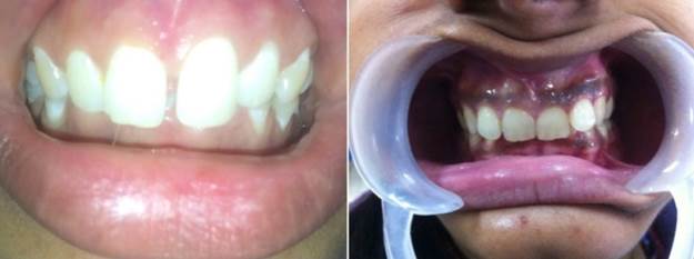 Un archivo externo que contiene una imagen, ilustración, etc. El nombre del objeto es TODENTJ-9-250_F5.jpg