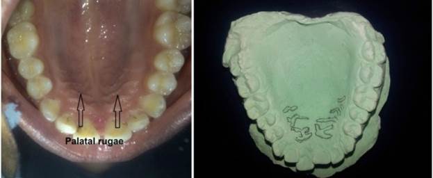 Un archivo externo que contiene una imagen, ilustración, etc. El nombre del objeto es TODENTJ-9-250_F6.jpg