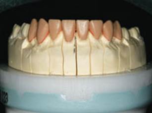 https://www.dentistrytoday.com/Media/EditLiveJava/1111_Engelberg_13.jpg