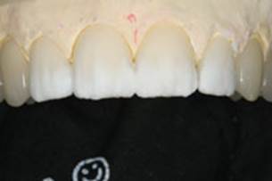 https://www.dentistrytoday.com/Media/EditLiveJava/1111_Engelberg_18.jpg