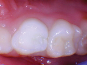 wren-case-1-figure-1