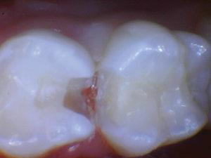 wren-case-1-figure-2