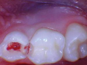 wren-case-1-figure-3