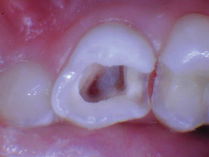 wren-case-1-figure-4