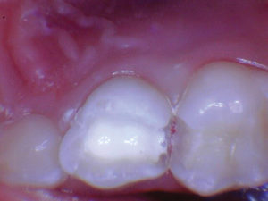 wren-case-1-figure-6