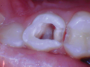 wren-case-1-figure-5