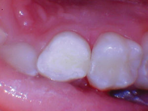 wren-case-1-figure-7