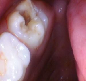 wren-case-2-figure-1