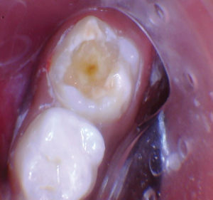 wren-case-2-figure-2