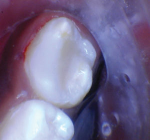 wren-case-2-figure-3