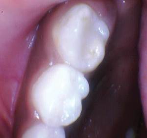 wren-case-2-figure-4