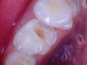 wren-case-3-figure-2