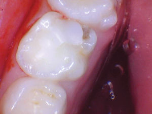 wren-case-3-figure-1