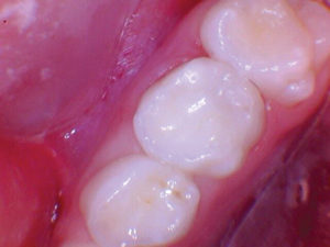 wren-case-3-figure-3