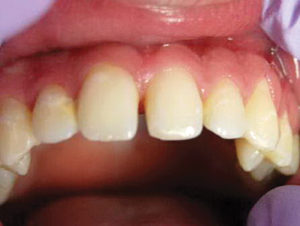 wren-case-4-figure-1