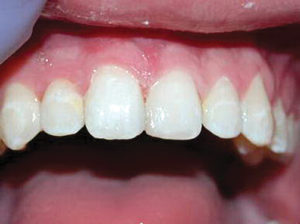 wren-case-4-figure-2