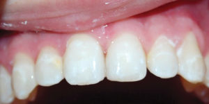 wren-case-4-figure-3