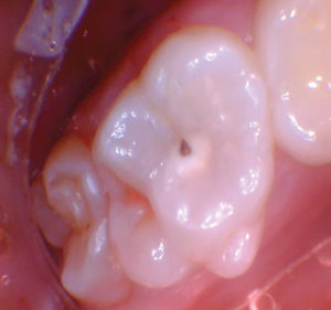 wren-case-5-figure-1