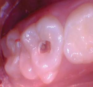 wren-case-5-figure-2