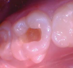 wren-case-5-figure-3