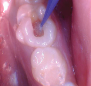 wren-case-5-figure-4