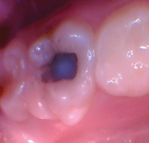 wren-case-5-figure-5