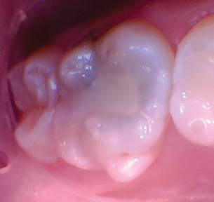 wren-case-5-figure-6