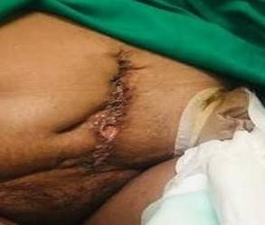 Descripción: Una persona acostado en una cama  Descripción generada automáticamente